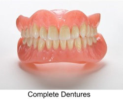 complete-dentures